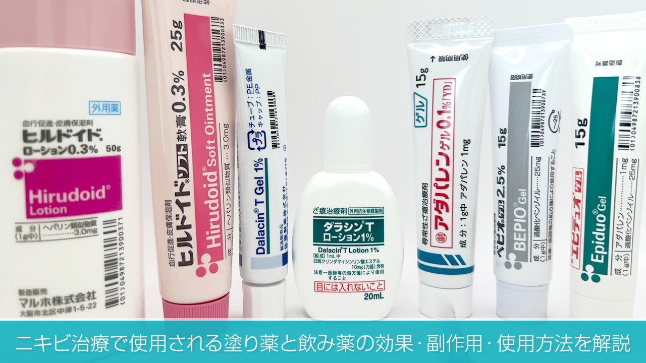 ニキビ治療で使用される塗り薬と飲み薬の効果・副作用・使用方法を解説