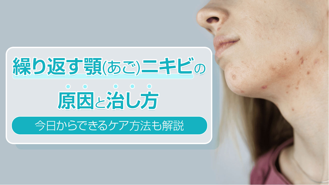 繰り返す顎(あご)ニキビの原因と治し方｜今日からできるケア方法も解説