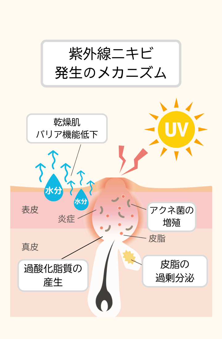 紫外線によるダメージ