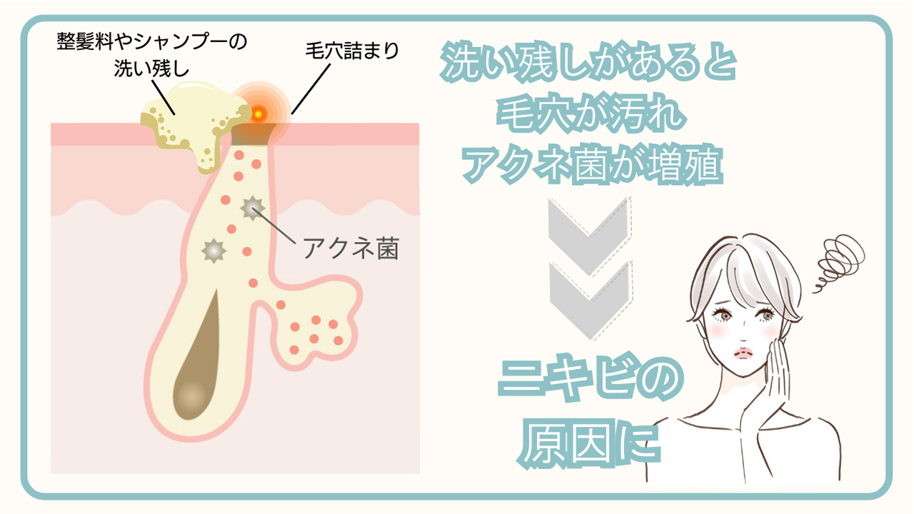洗い残し
