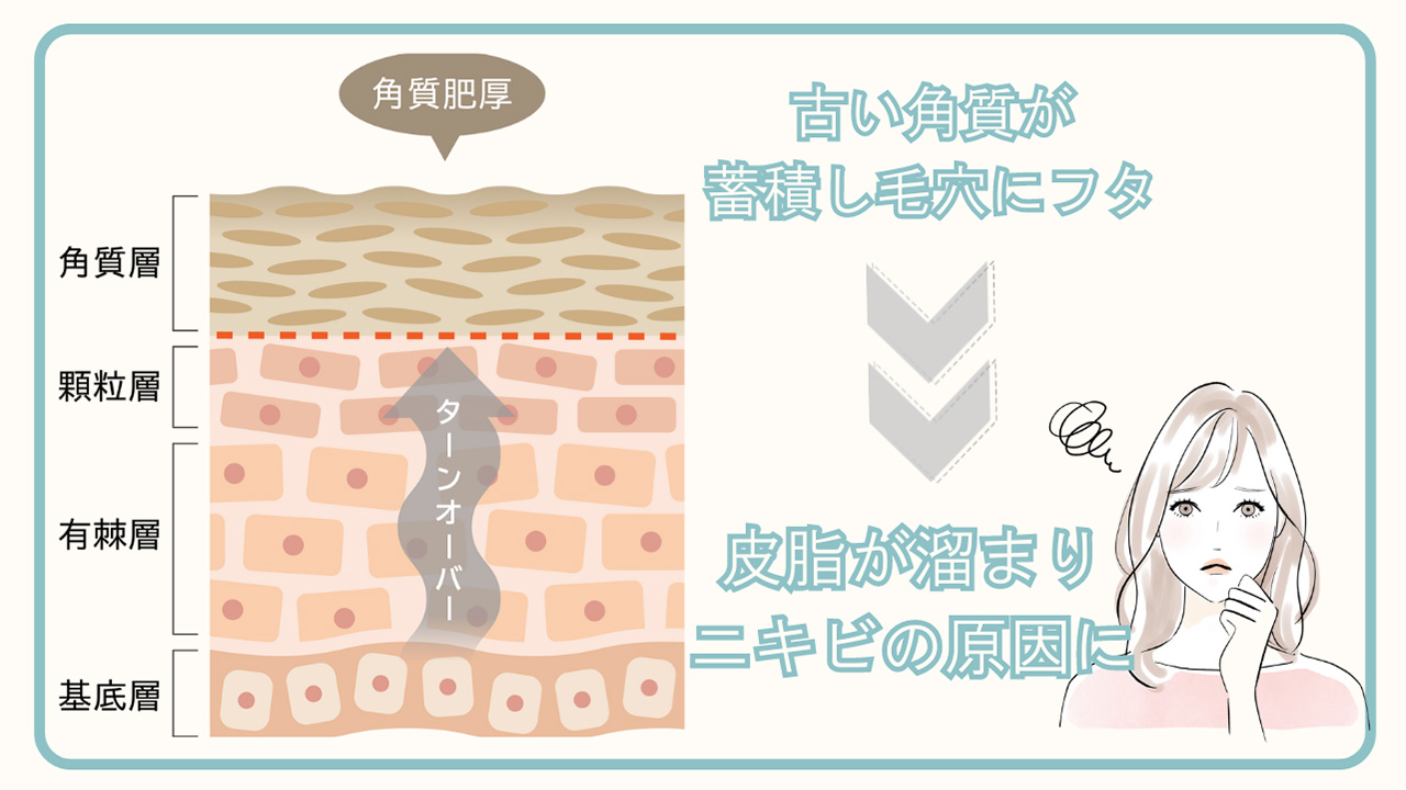 古い角質