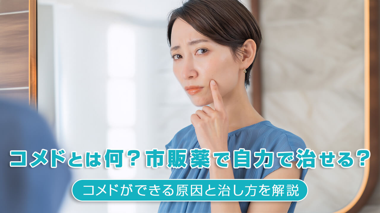 コメドとは何？市販薬で自力で治せる？コメドができる原因と治し方を解説