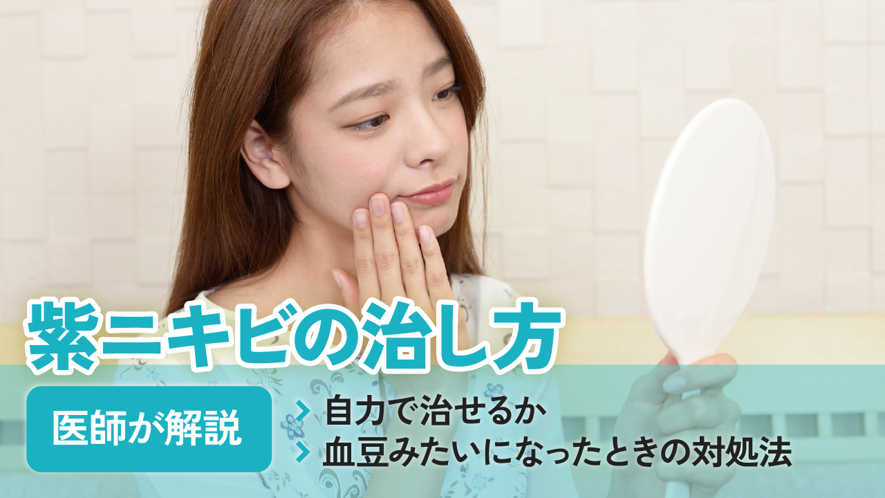 紫ニキビの治し方｜自力で治せるか・血豆みたいになったときの対処法を医師が解説