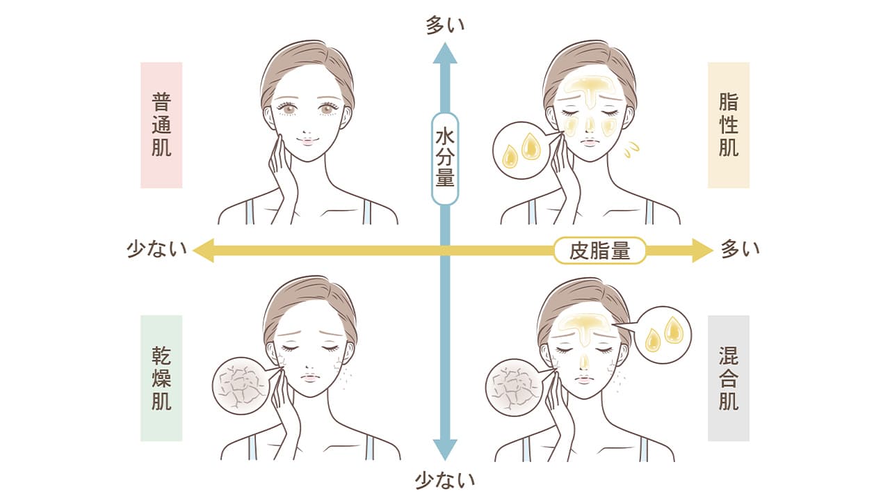 肌質で見分ける│ニキビの種類・症状