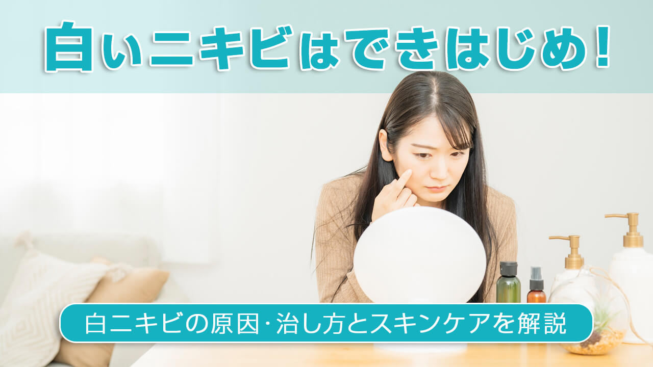 白いニキビはできはじめ！白ニキビの原因・治し方とスキンケアを解説