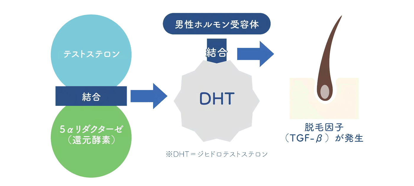 AGA発生の仕組み