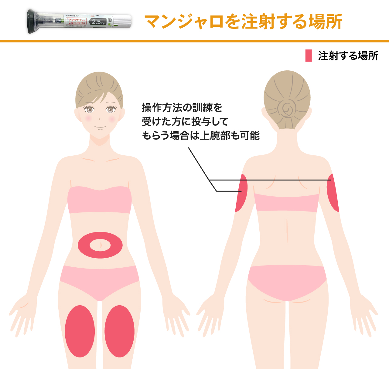マンジャロを注射する場所:太もも・お腹※操作方法の訓練を受けた方に投与してもらう場合は上腕部も可能