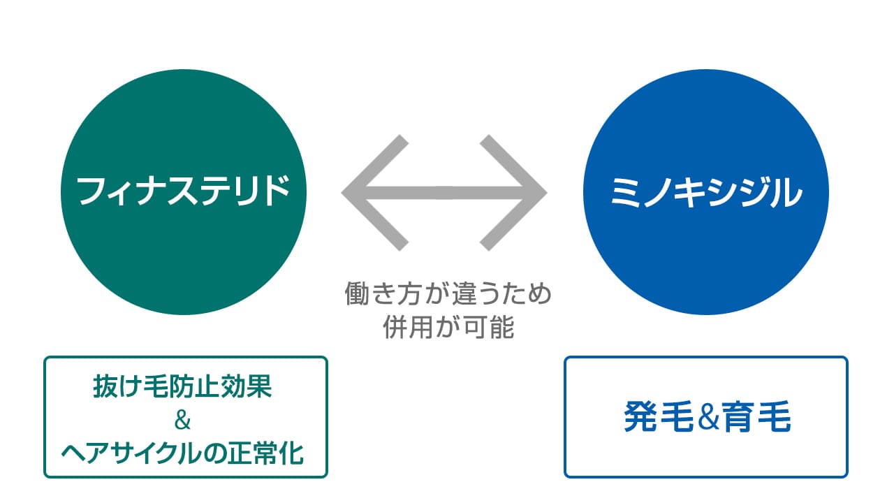 フィナステリドとミノキシジルの併用