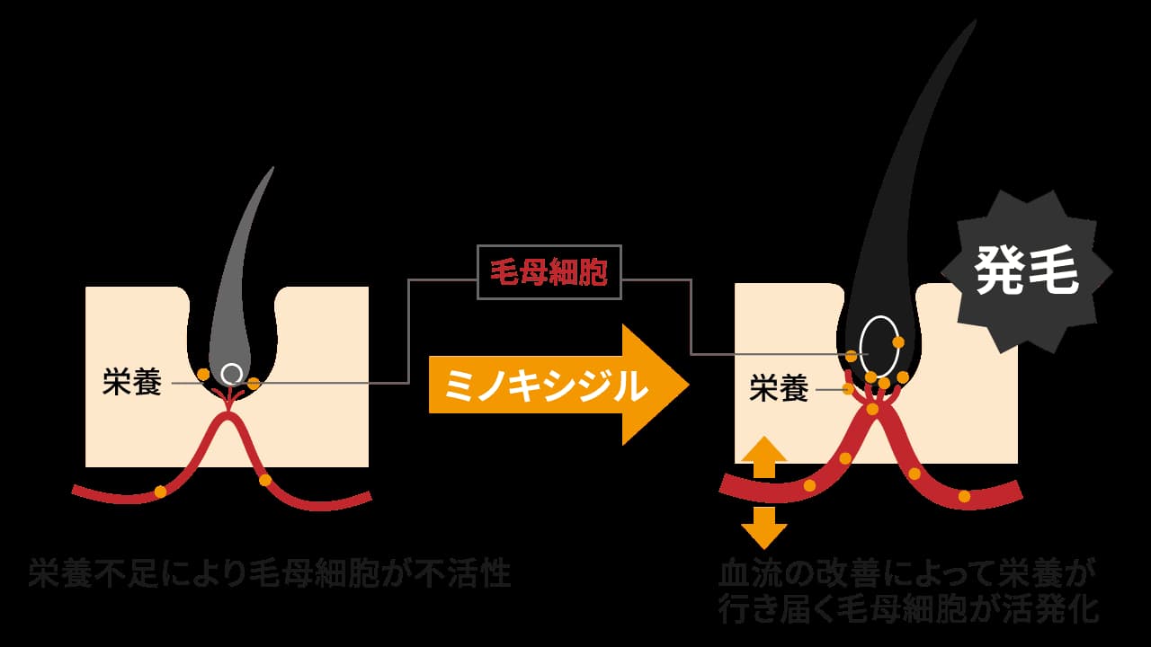 ミノキシジルの作用機序