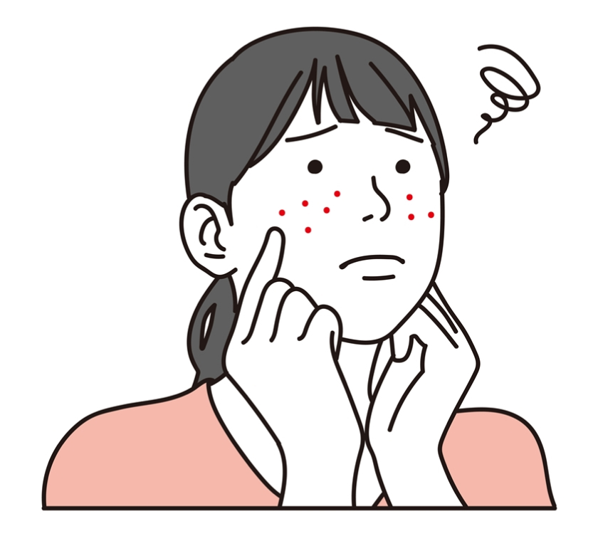 重症ニキビかも