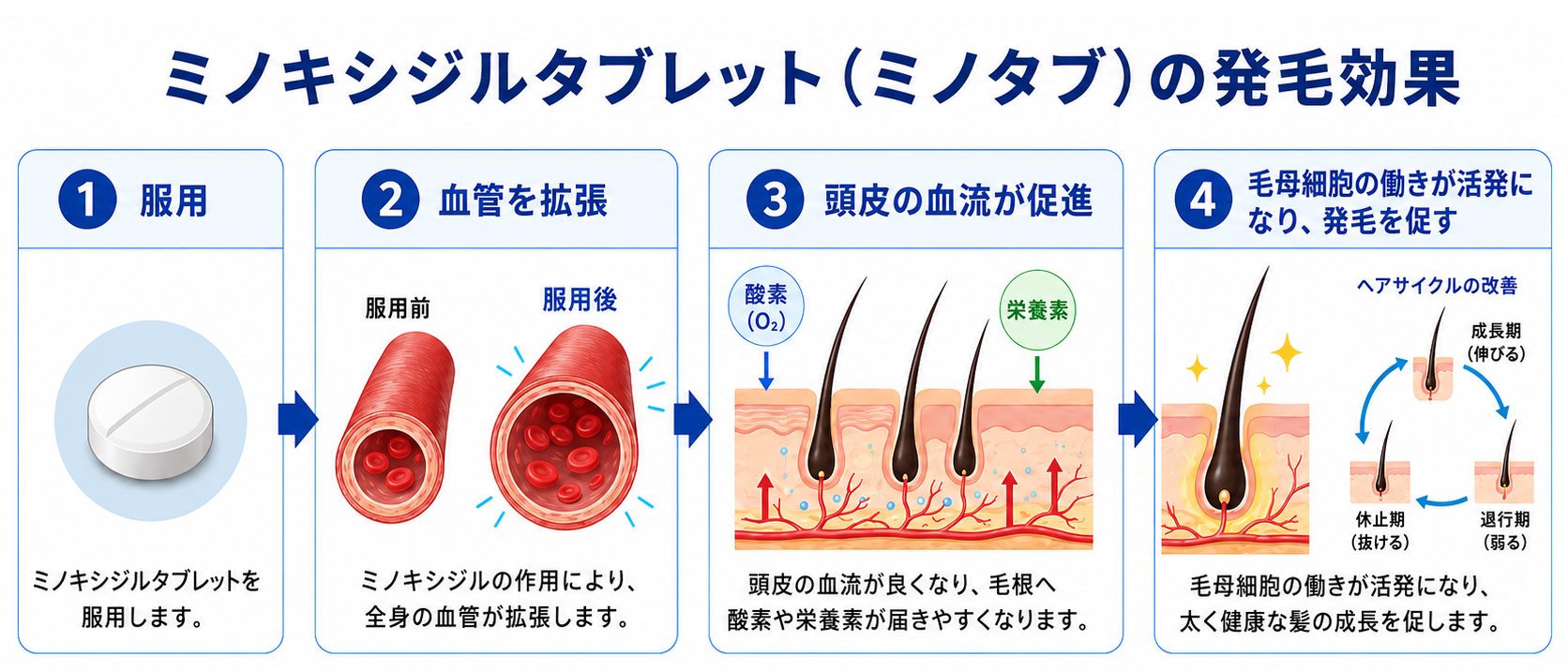 ミノキシジルタブレット（ミノタブ）の発毛効果‐①服用②血管を拡張③頭皮の血流が促進④毛母細胞の働きが活発になり、発毛を促す