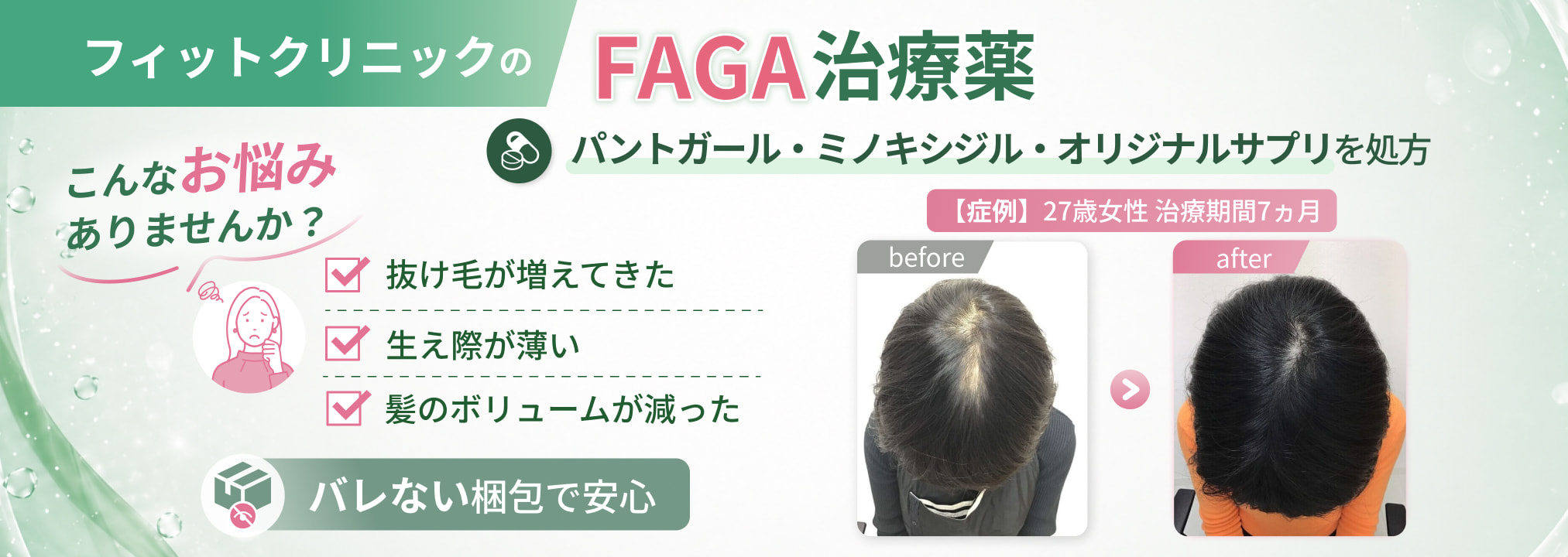 こんなお悩みの方へ/抜け毛が増えてきた・生え際が薄い・髪のボリュームが減った/フィットクリニックのFAGA治療薬/パントガール・ミノキシジル・オリジナルサプリを処方/バレない梱包で安心
