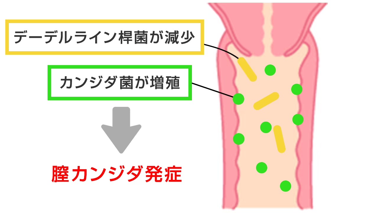 抗生物質が原因でカンジダを発症するしくみ