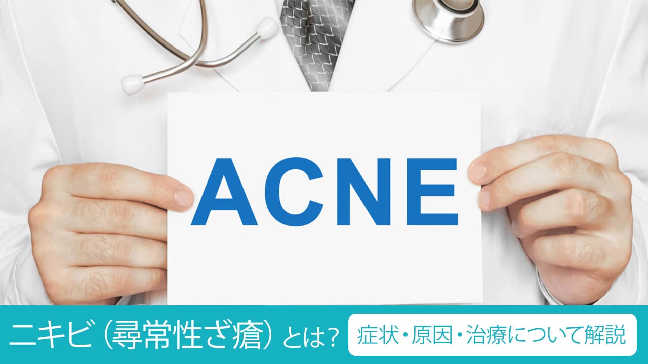 重症ニキビの詳細