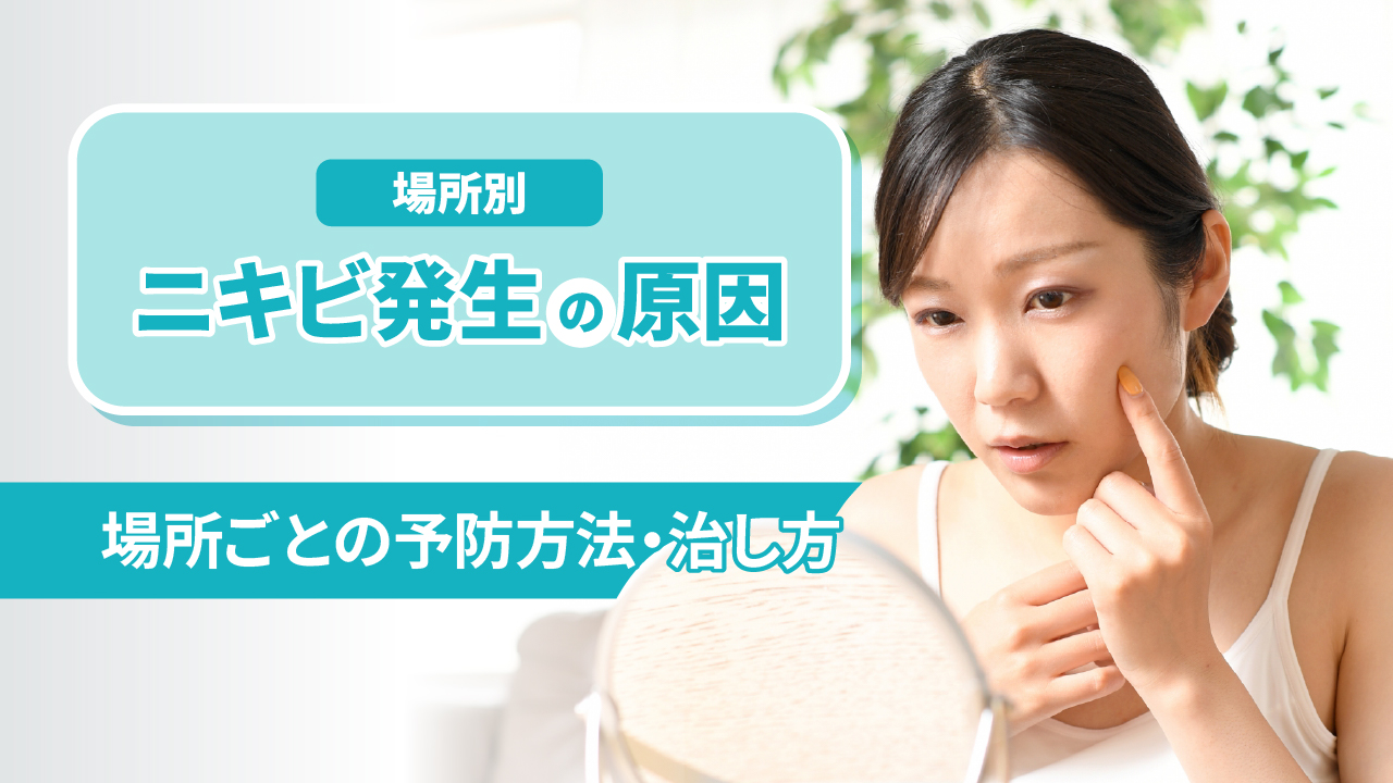 【場所別】ニキビ発生の原因 - 場所ごとの予防方法・治し方