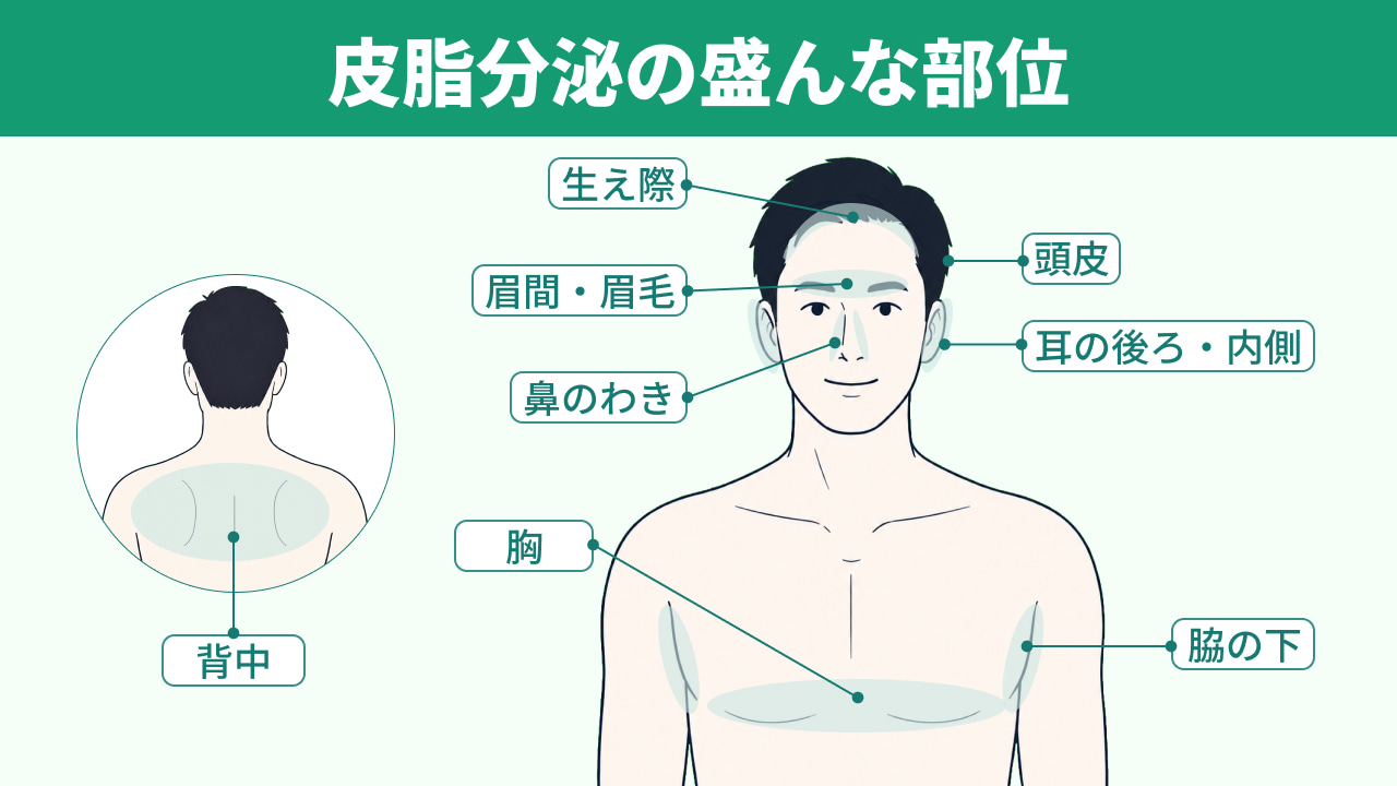 脱毛を起こす「脂漏性皮膚炎」