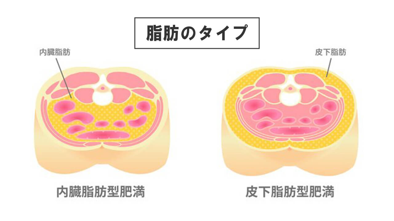 脂肪のタイプ