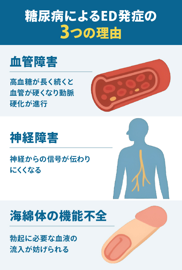 糖尿病によるED発症の3つの理由：血管障害により血管が硬くなり動脈硬化が進む、神経障害により神経信号が伝わりにくくなる、海綿体の機能不全により血液の流入が妨げられる