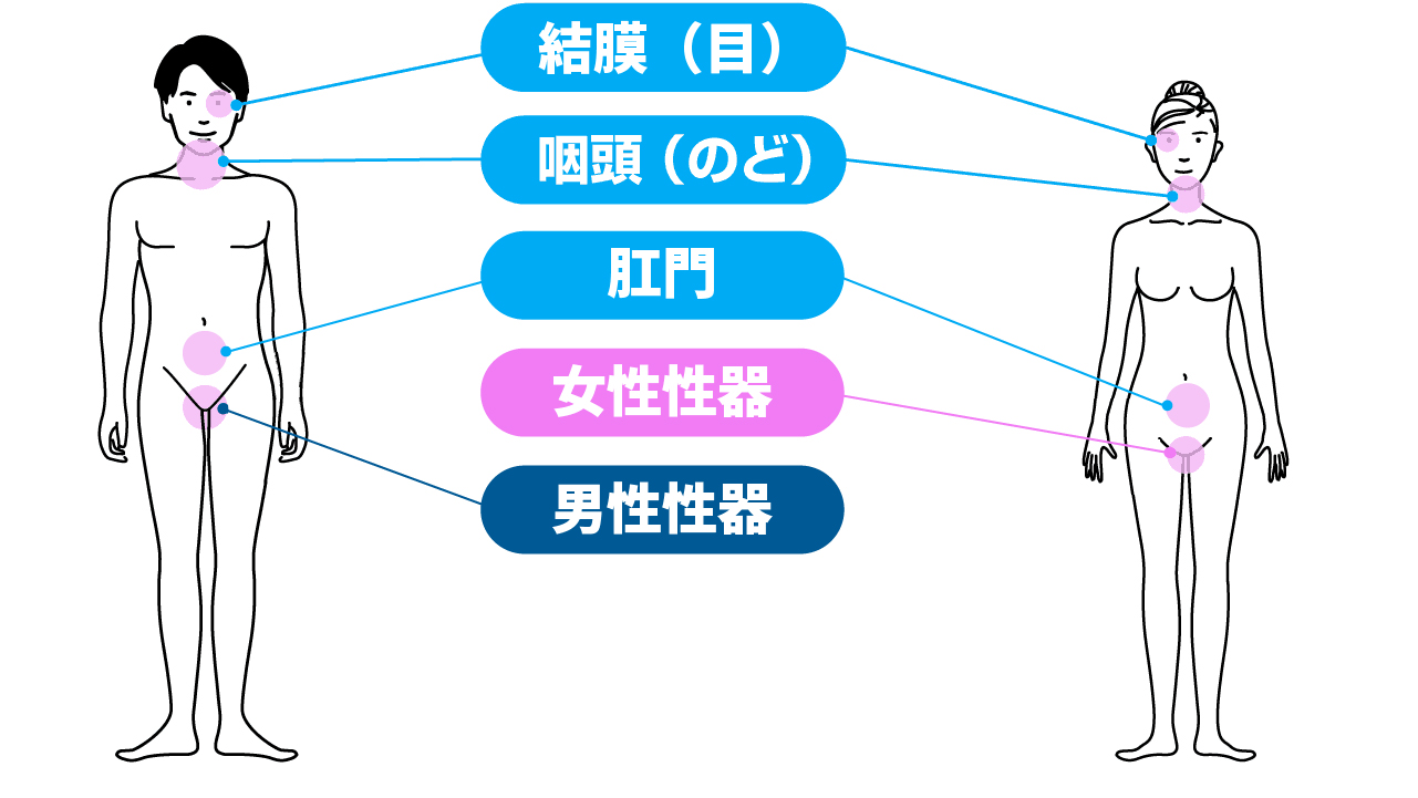 クラミジアの症状:男性:肛門、直腸、男性性器、結膜、咽頭・女性:肛門、直腸、女性性器、結膜、咽頭