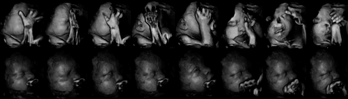喫煙者と非喫煙者の母親の胎児の比較