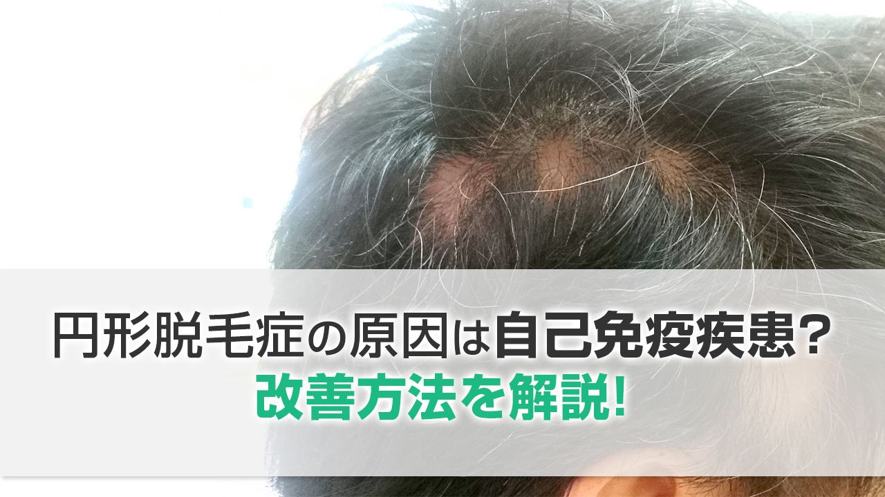 脱毛を引き起こす可能性のある薬