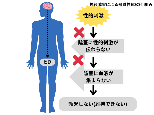 神経障害によるEDの仕組み　イメージ画像