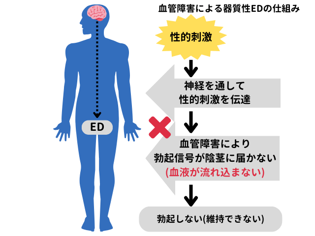 血管障害によるEDの仕組み