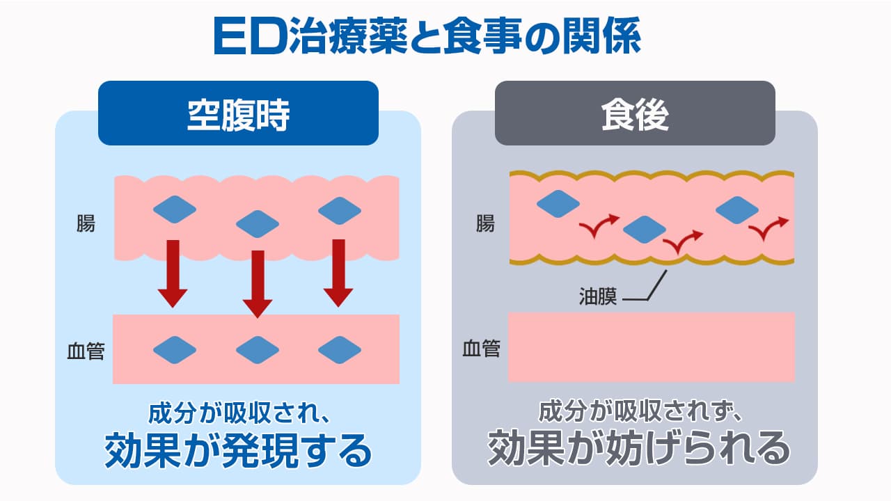 ED治療薬と食事の関係、腸壁の油分が成分の吸収を遅延させることを示している