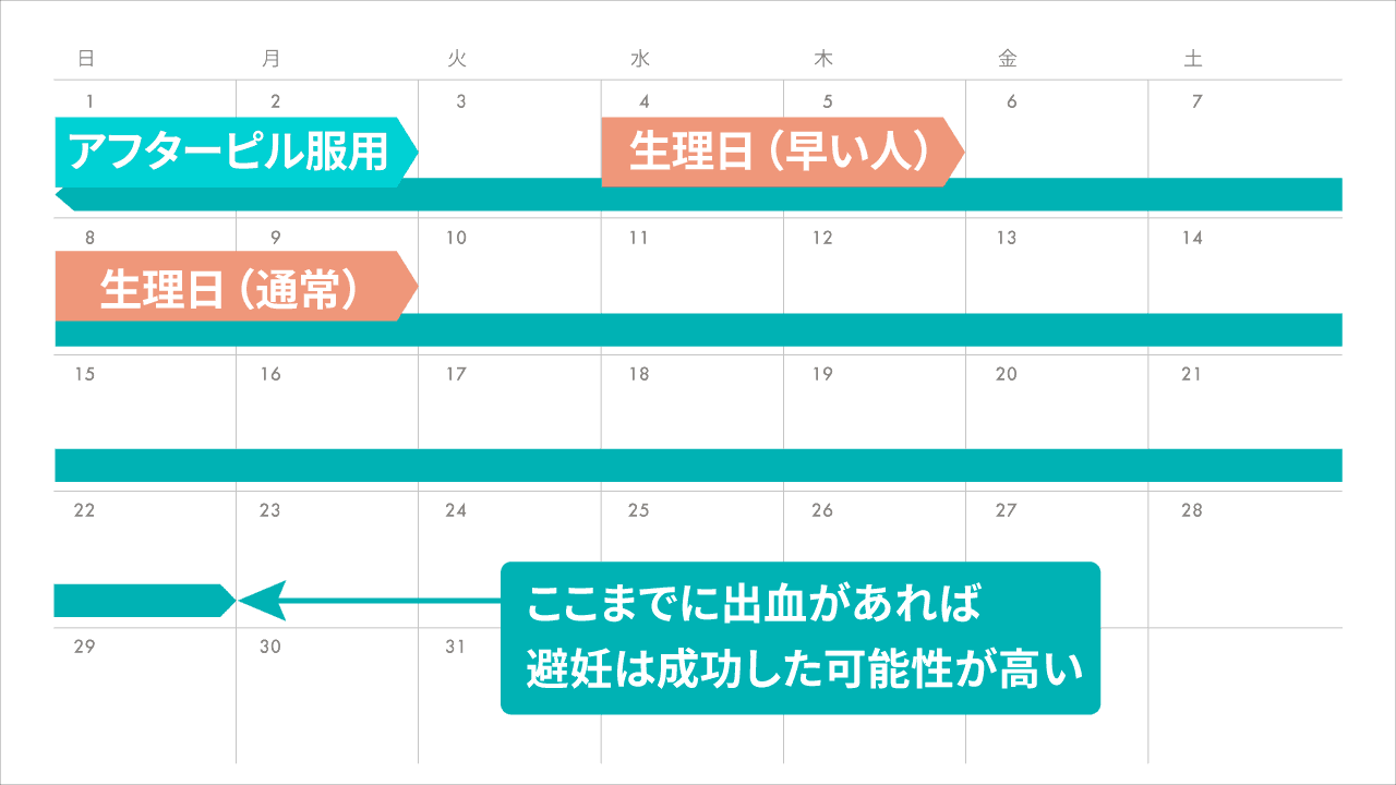 薬による中絶を受けるのはどのような感じですか?