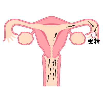 低用量ピルの避妊効果は精子の侵入を阻止できること