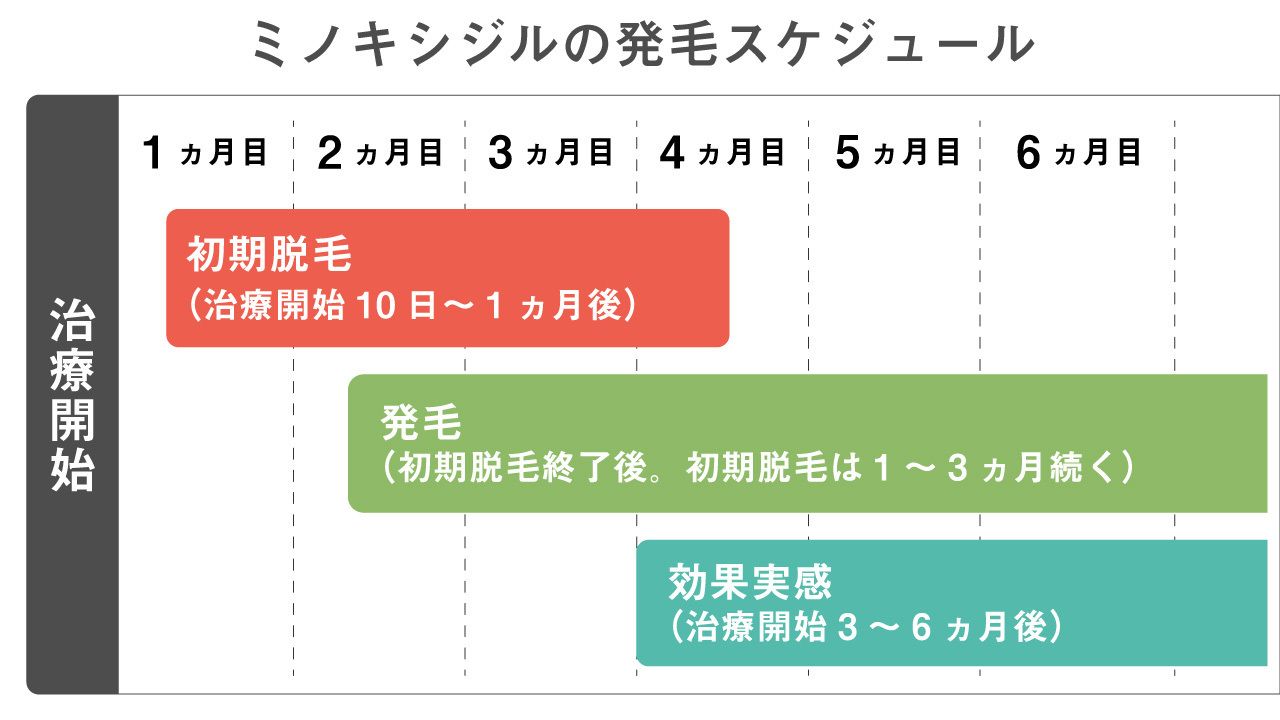 ミノキシジルの発毛スケジュール