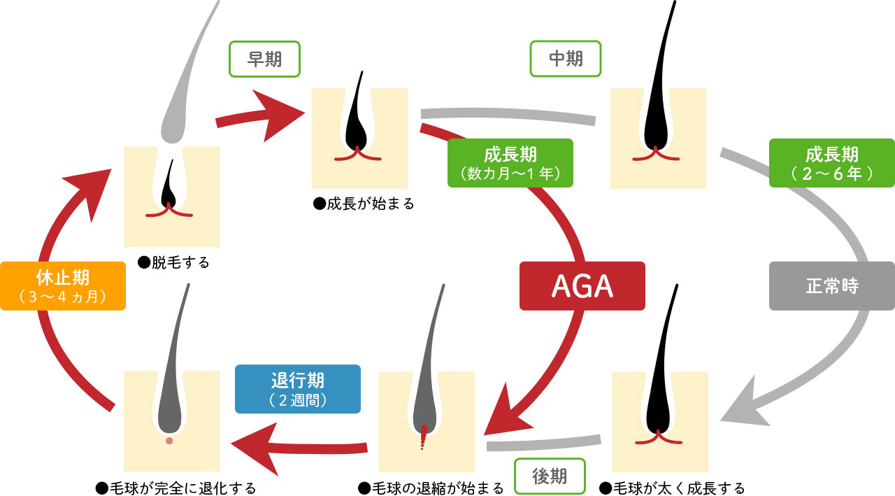 初期脱毛の場合は経過を見る