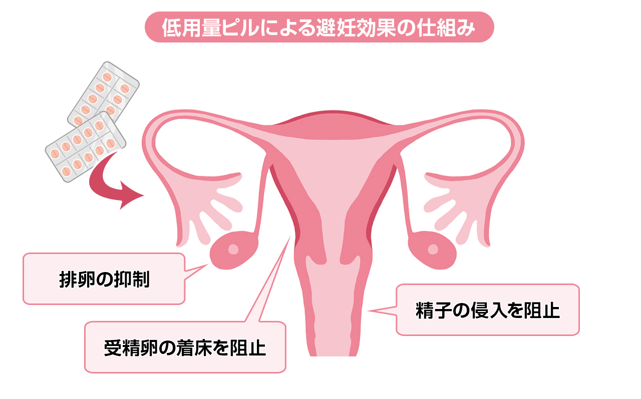 低用量ピルによる避妊効果の仕組み