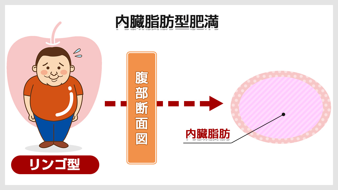 内臓脂肪型肥満